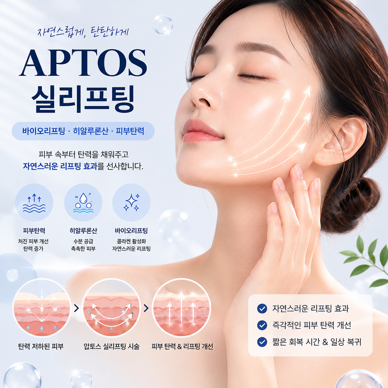 APTOS 실리프팅: 자연스러운 리프팅 효과