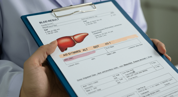 간수치 내리는 방법 사진 20