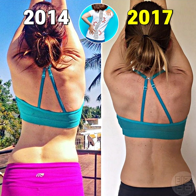 기지개 펴기 효과 휜허리 교정, 기지개 켜기 운동 효과, 건강 팁줌 매일꿀정보