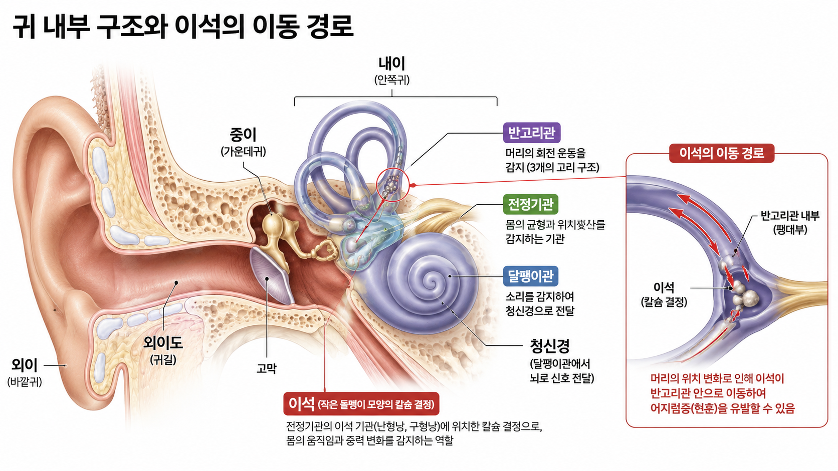 갑자기 방이 빙빙 돈다면,이석증일 가능성이 높습니다