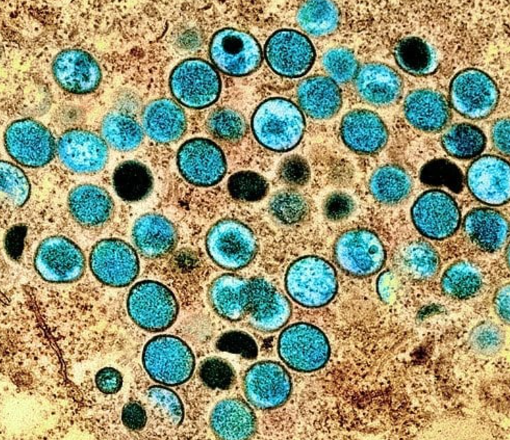 엠폭스 증상 감염경로