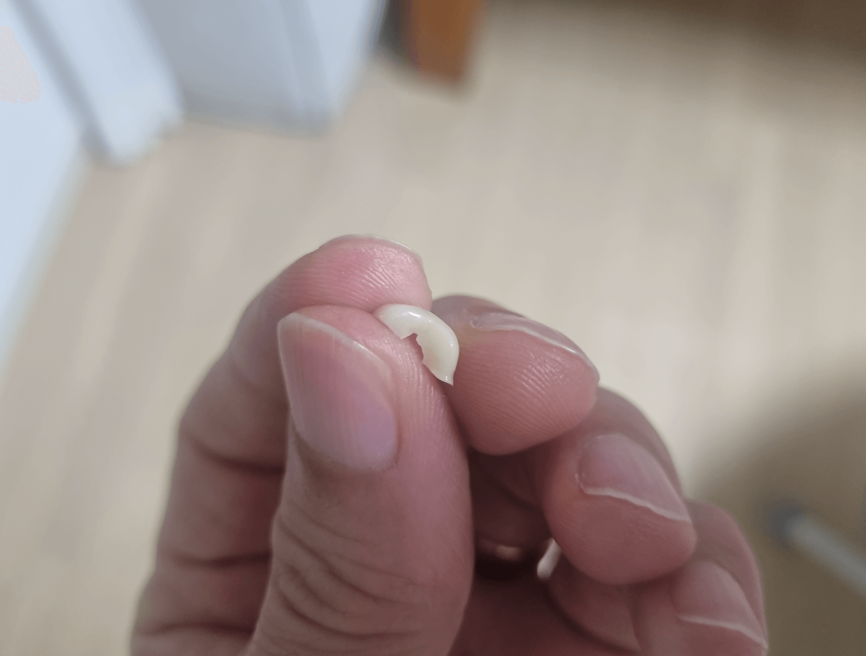 임플란트 크라운 깨짐