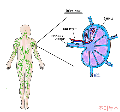 림프절이란?
