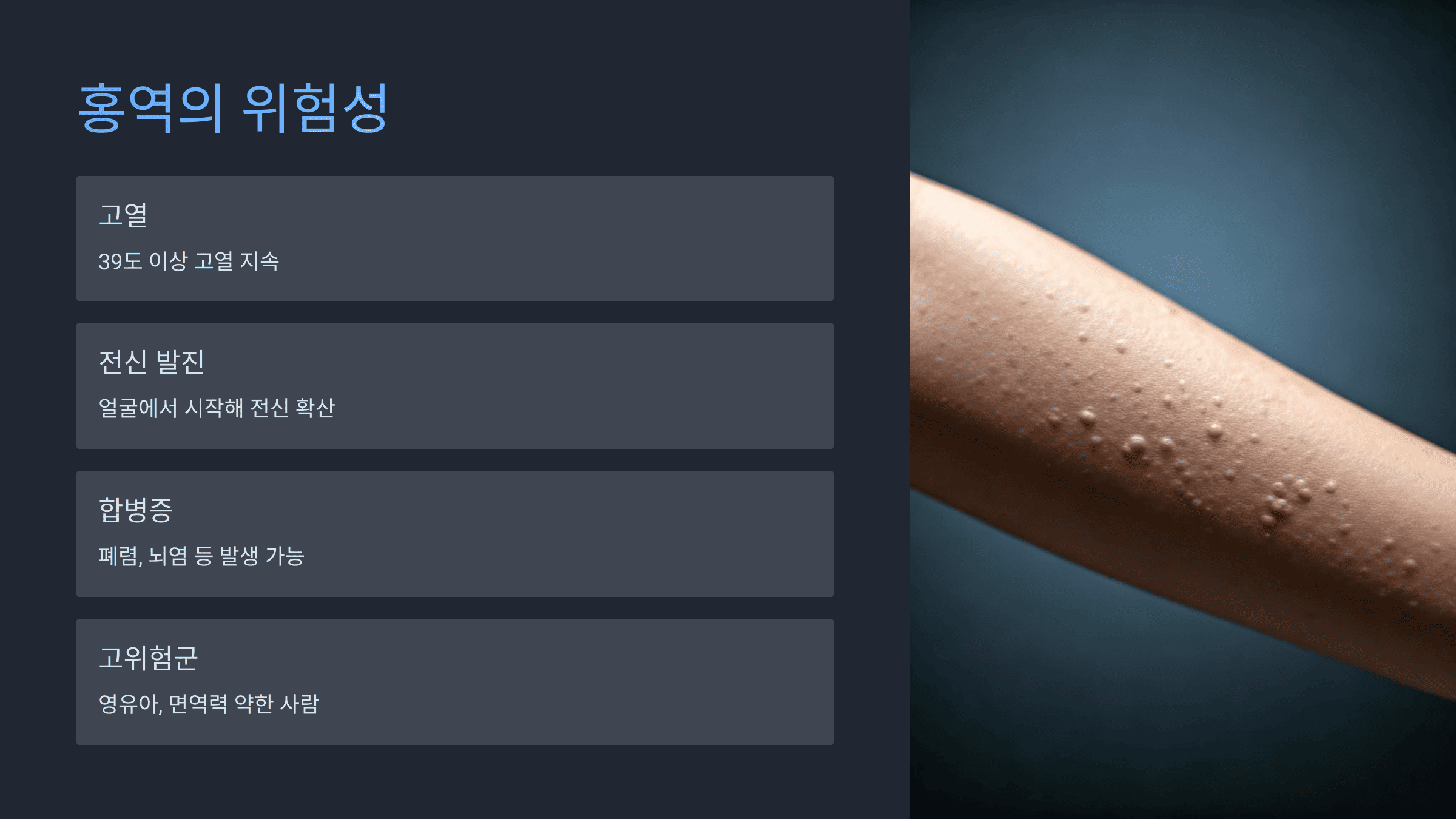 배트남 홍역 감염 경로와 예방 수칙