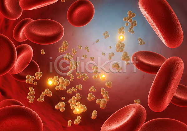 혈당스파이크 증상