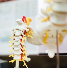 통풍 치료법 진단 기준 합병증