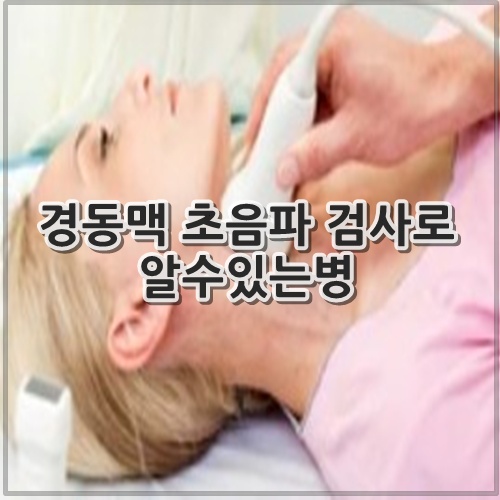 경동맥 초음파 검사로 알수있는병