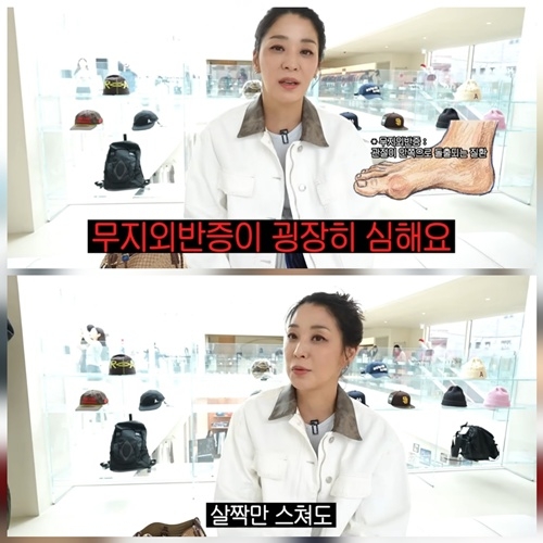한고은 나이 프로필 남편 신영수 무지외반증 근황 및 다이어트 식단 총정리