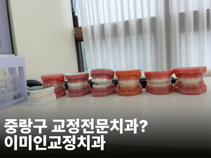 여름방학 치아교정 시작, 이미인교정치과, 동대문구 교정치과
