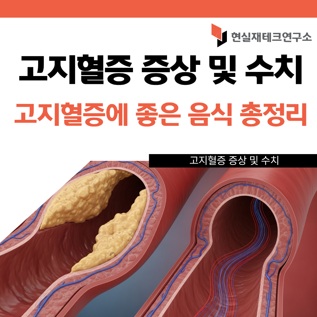 고지혈증