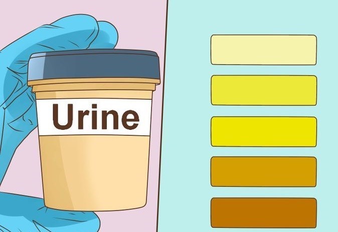 오줌 색깔과 병
