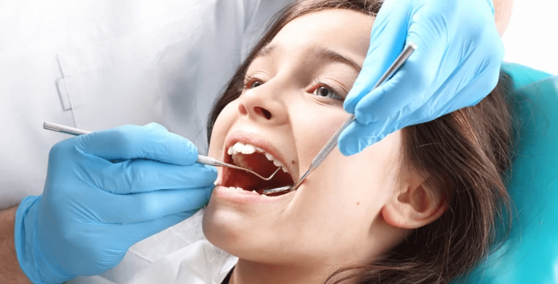 치아 홈메우기 가격