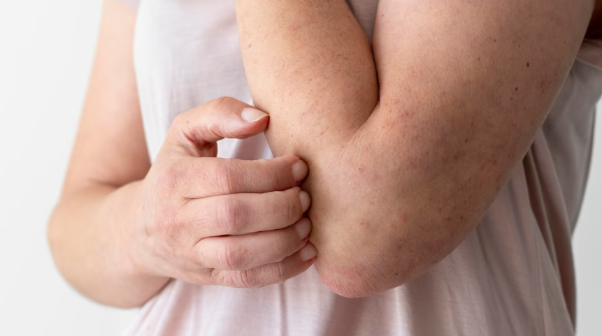 심한 아나팔락시스의 증상