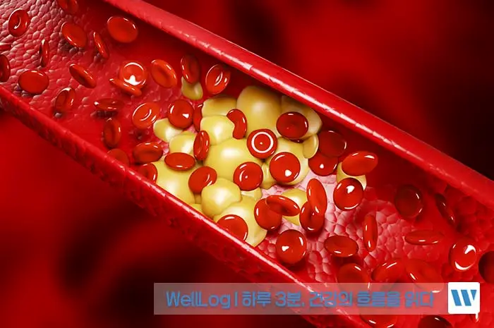 녹차 추출물 카테킨 EGCG 효능, 복용방법, 주의사항