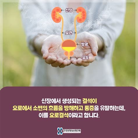 요로 결석 보험