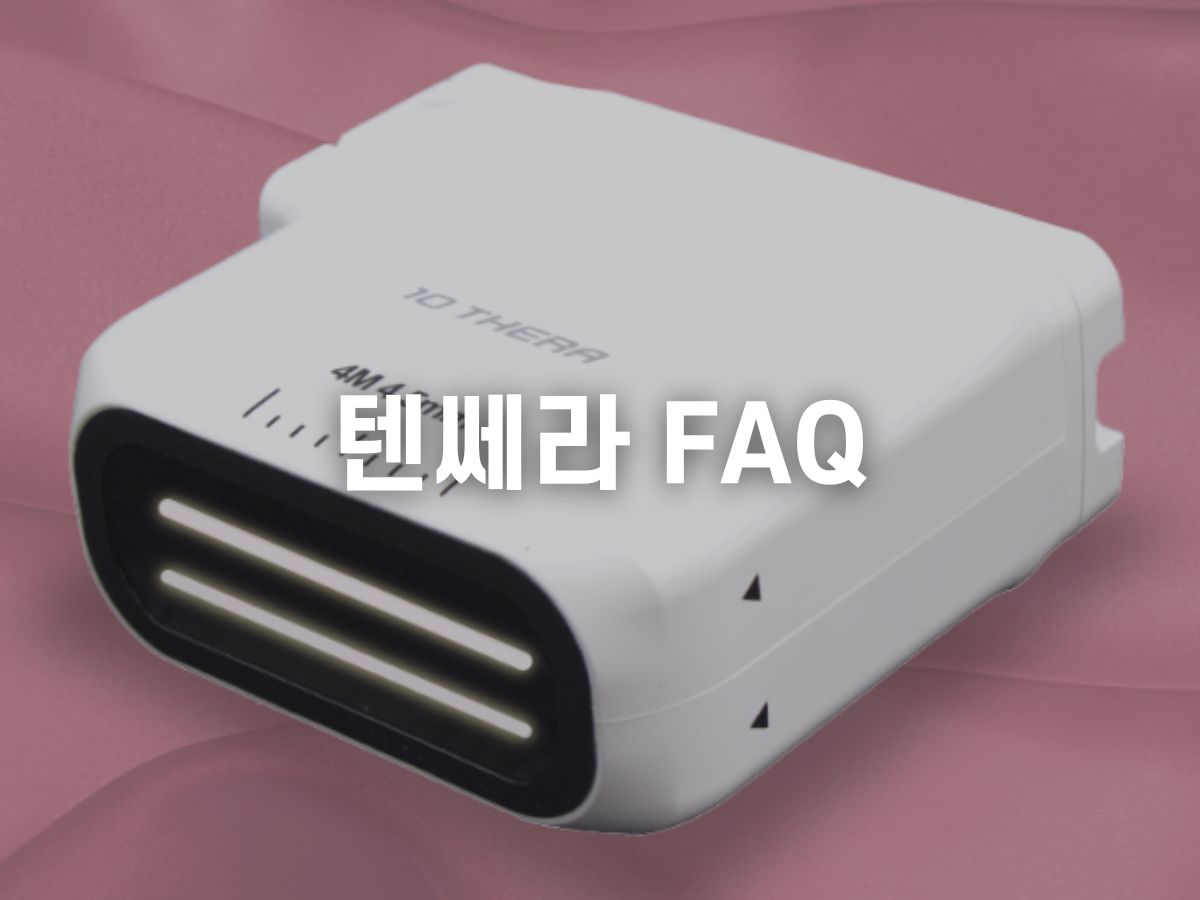 텐쎄라 FAQ