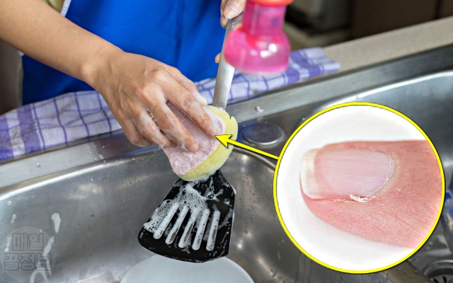 손톱 주변 살, 까시래기 거스러미, 손톱 옆 갈라짐 염증, 건강 팁줌 매일꿀정보