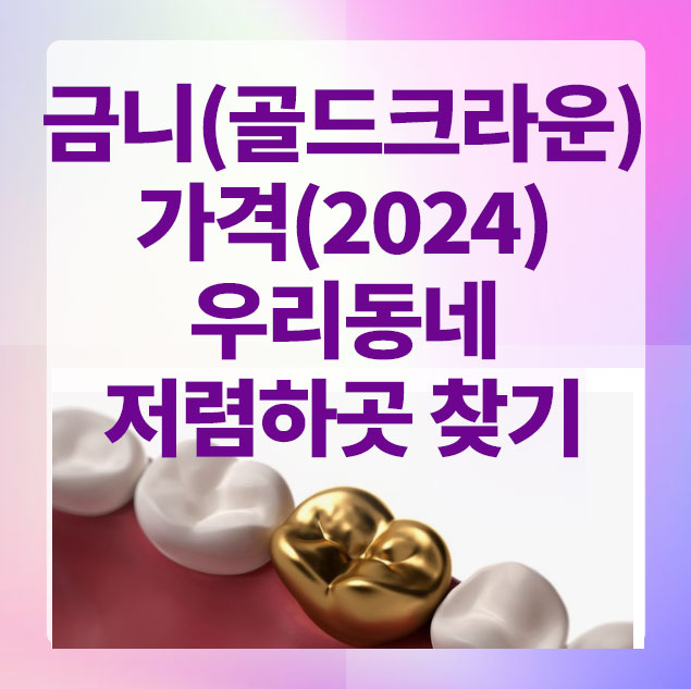 금니가격