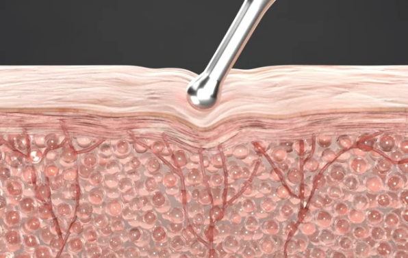 김희선 마사지기 원리