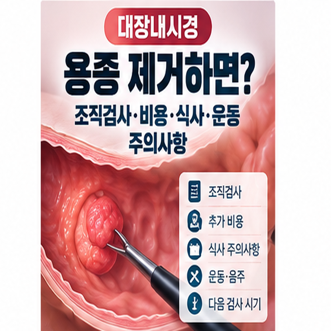 대장내시경 용종 제거 후 조직검사 비용 식사 운동 주의사항