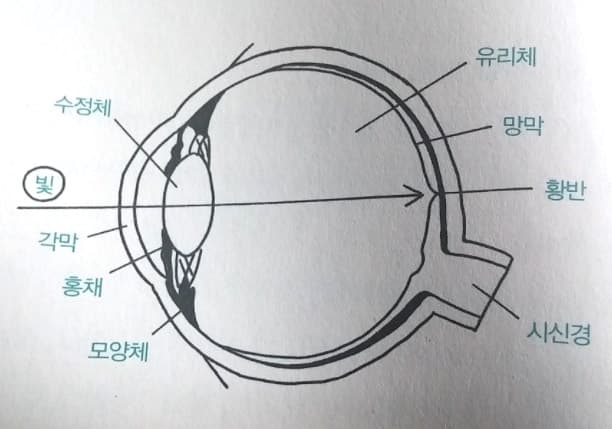 비문증