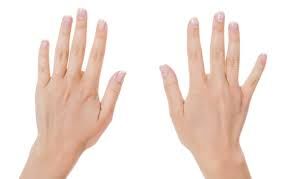 손톱 세로줄 무늬