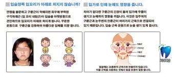 입술 떨림 원인 증상 10가지와 치료 방법 총정리_12