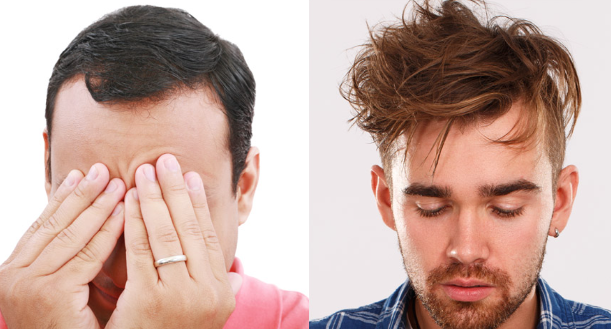 두피 관리, 트리트먼트, 스타일링 사진