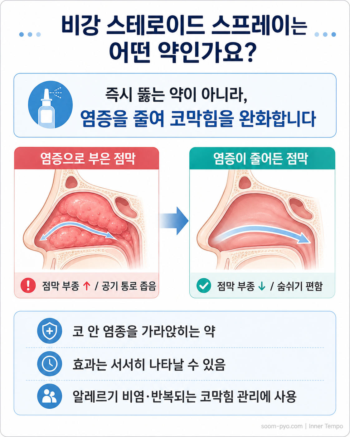 비강 스테로이드 스프레이 안내