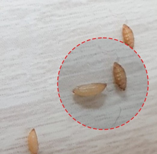 좀벌레 알 확인하기