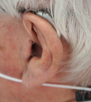 이명 치료법 진단 기준 합병증 관리