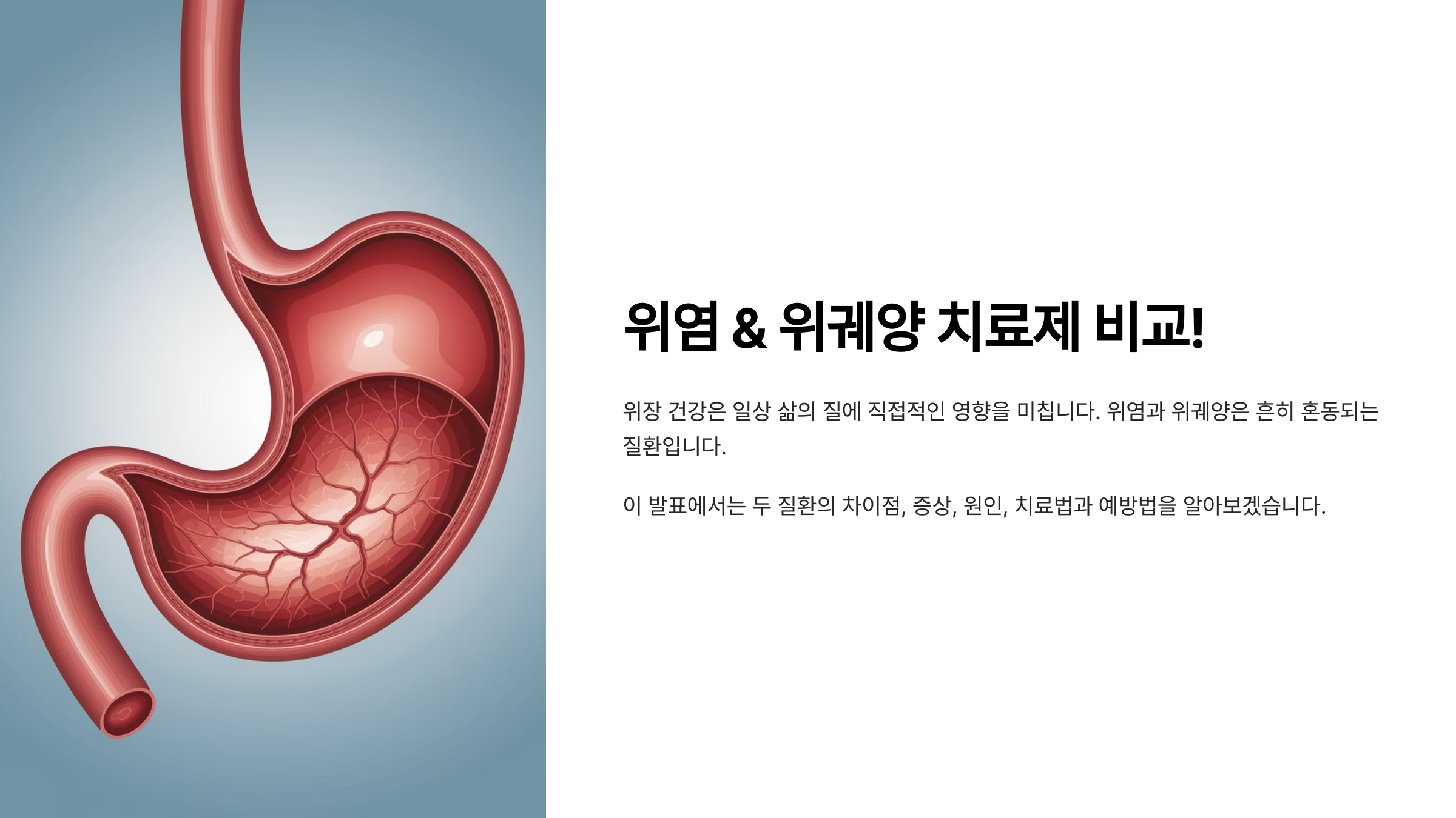 위염 & 위궤양 치료제 비교