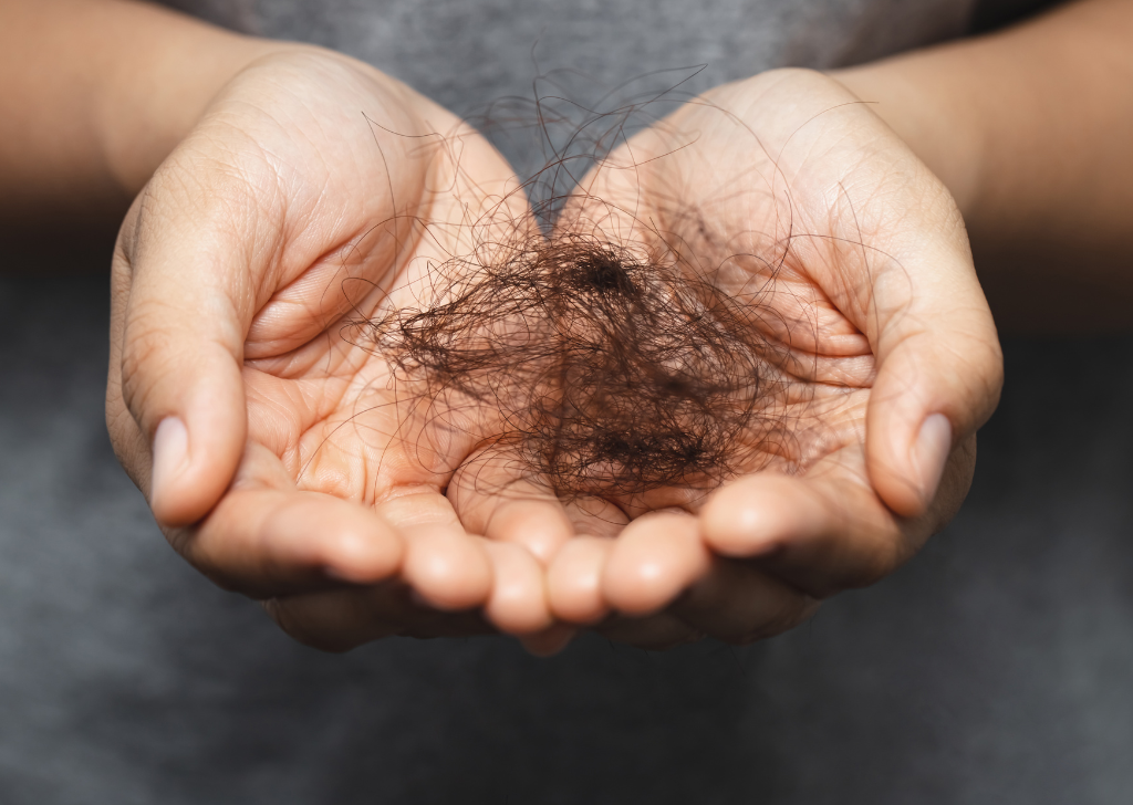 탈모 자가진단법