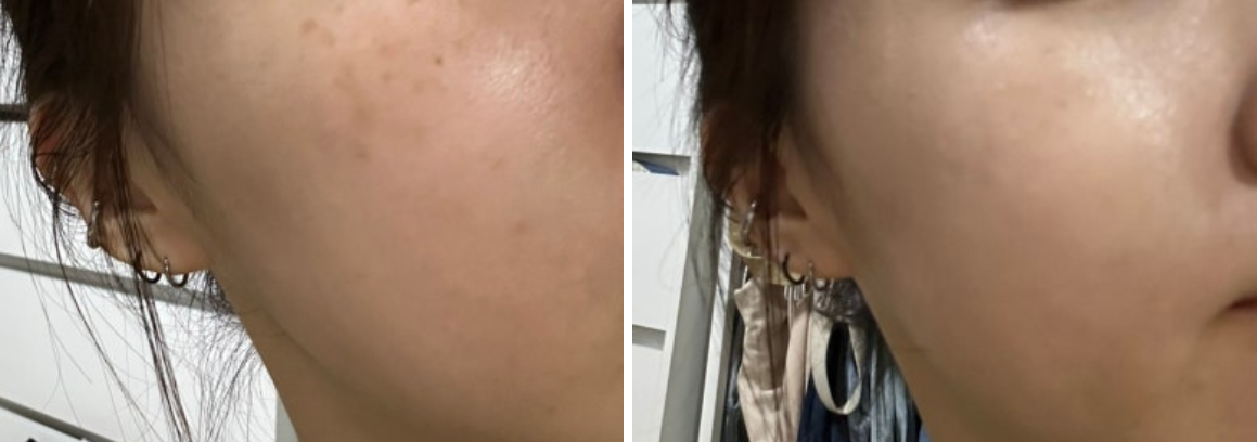 블랑로더 탄탄쿠션 효과