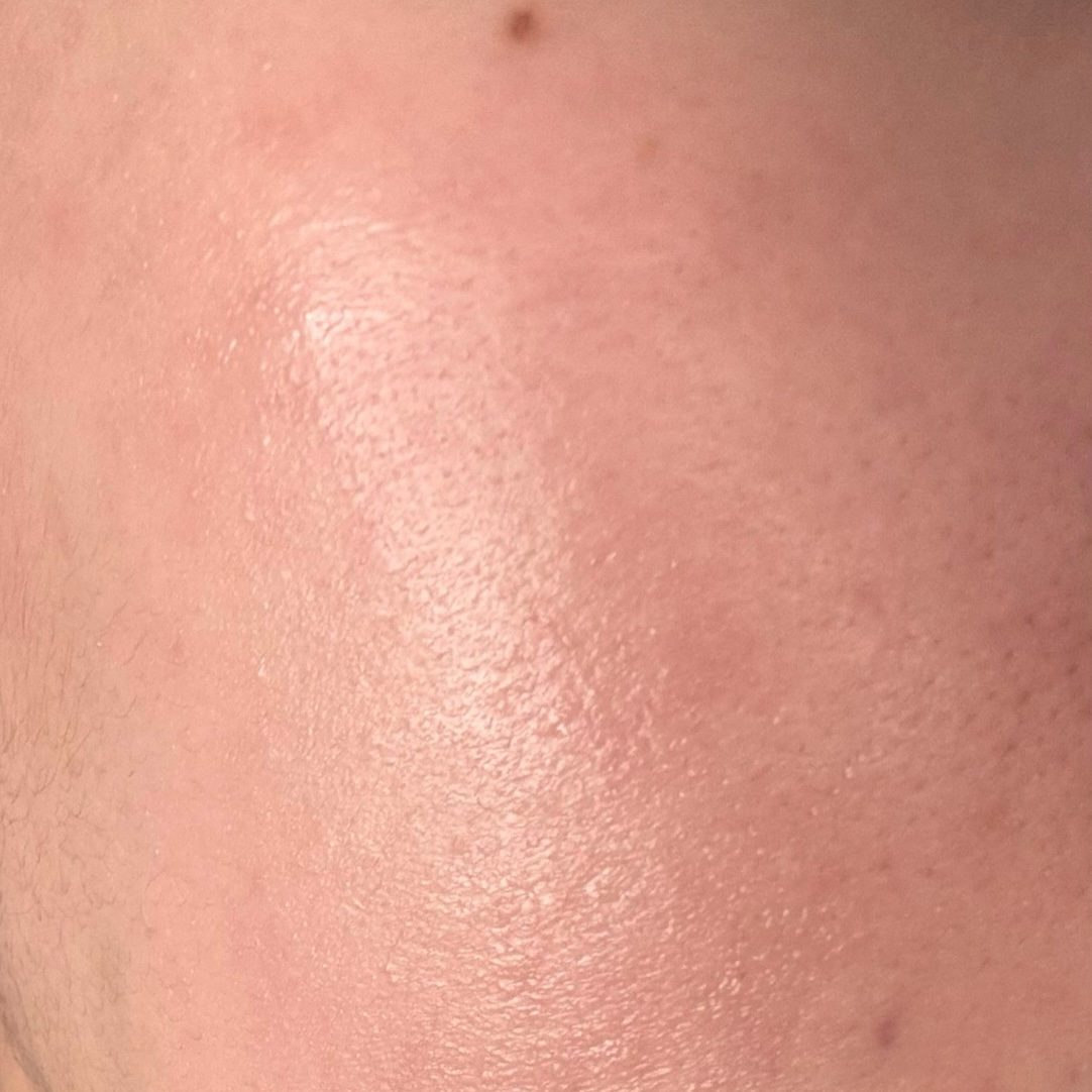 유산균 섭취 했었을 때 사진