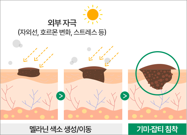 기미생성 과정
