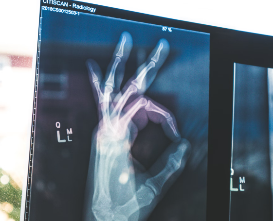 마그네슘 효능 : 뼈건강