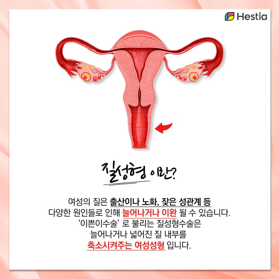 이쁘니수술이란?