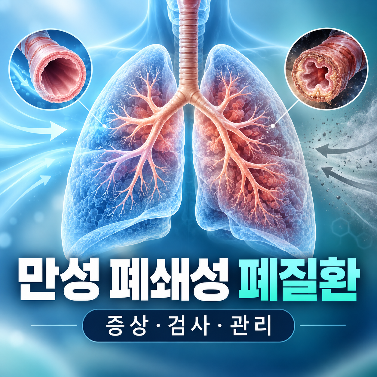 만성 폐쇄성 폐질환