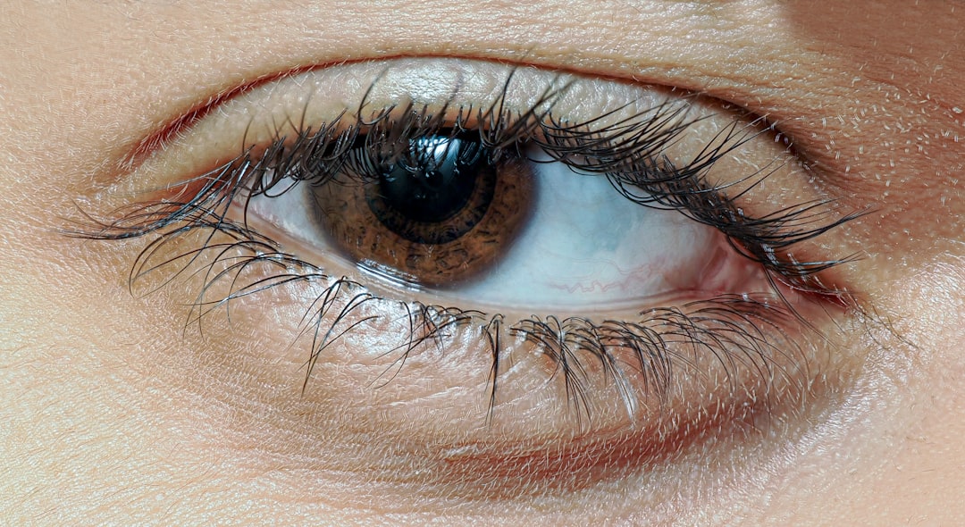 Eye disease