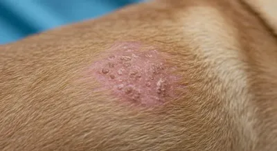 피부를 통해 나타나는 알레르기 초기 증상