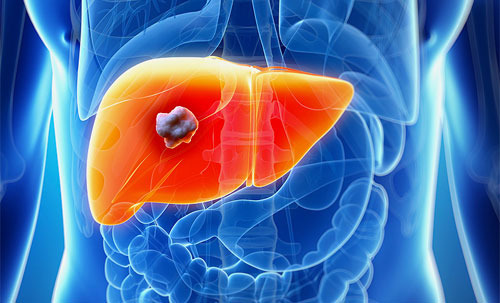 간이 안좋을때 나타나는 증상 8가지