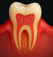 잇몸이 붓고 아플 때