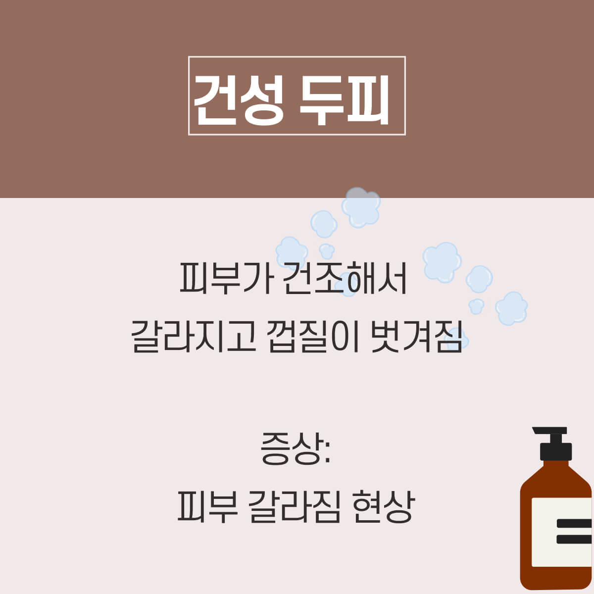 머리가 가려운 이유: 머리 가려움 증상 해결 방법