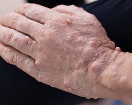 ์ ๊ฒฝ์ฌ์ ์ข