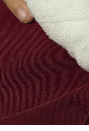 손가락마디통증