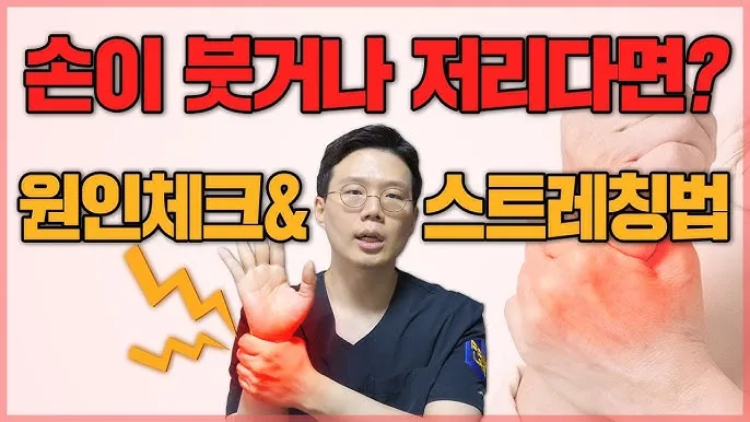 손등 붓는 이유 혈액순환 문제 증상과 해결법 정리_2