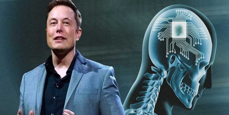 머스크, 두뇌 칩 인간 실험 곧 착수 Musk says brain chip to begin human trials soon