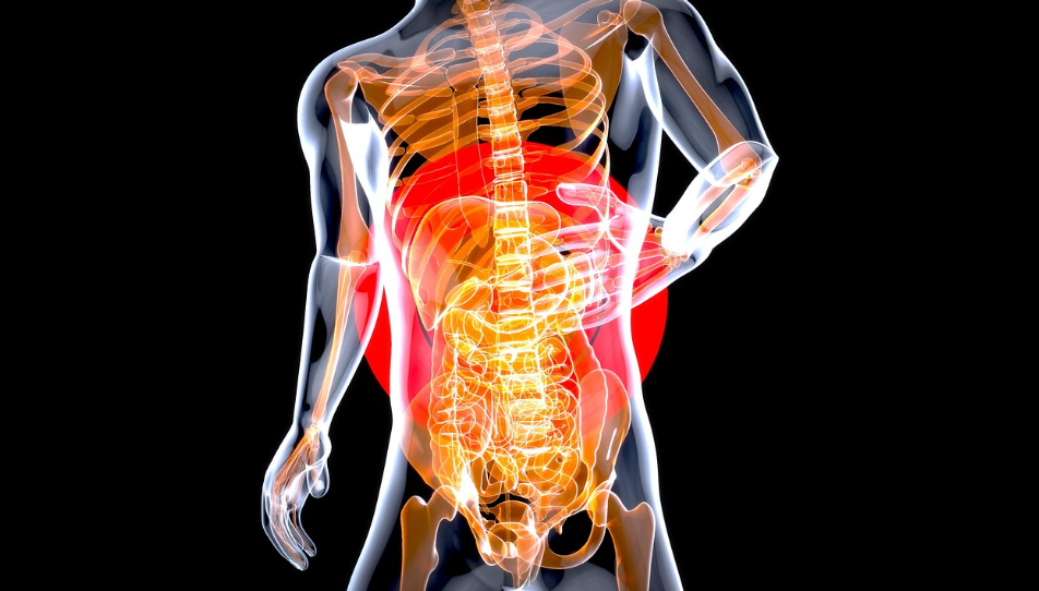 대장암&middot;직장암의 원인과 발병 요인, 예방과 조기 발견 방법