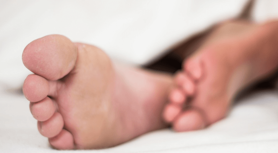 티눈 없애는 방법을 살펴보는 발